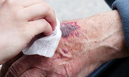 How To Speed Up Wound Healing